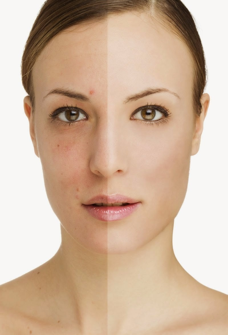 Acido Lactobionico 10 % Ph 3.5 Renovacion Antiage Idraet - Image 2